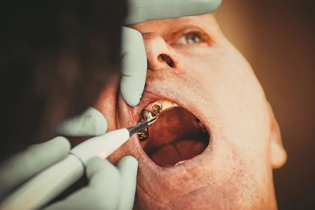 Tooth extraction injury claims in Wallsend